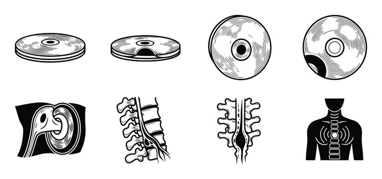 Set of human spine anatomy icons showing intervertebral disc herniation and nerve compression problems