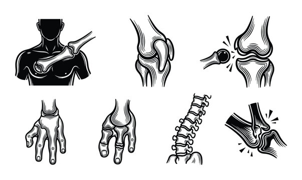 Orthopedic joint injury icons collection featuring knee shoulder hand and spine dislocation and pain