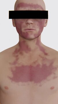 Ancomycin effected parts on body in Vertical Video | Vancomycin Indication in Vertical Video | Vancomycin
