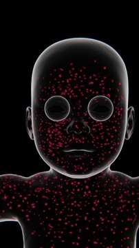 Measles effected parts on body in Xray Video | Measles Indication in Xray Video | Measles