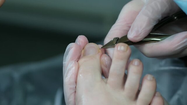A man cuts toe nail using a nail clipper. Foot and toes of an adult man, close-up shot. High quality 4k footage