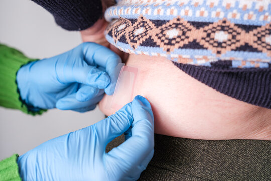 Hands wearing blue gloves applying a fentanyl patch.