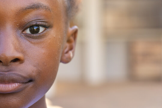 Left half of female child's face is occupying frame on porch, showing textured skin and coils