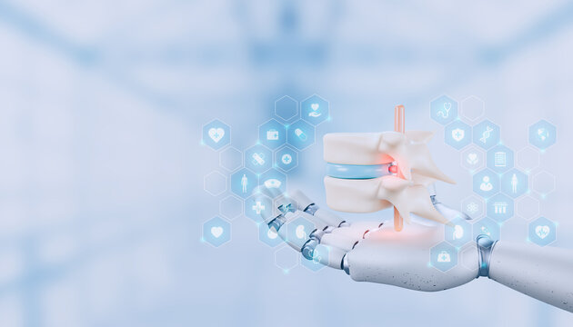 Robotic hand holding 3D model of herniated disc between two human vertebrae. Spinal diagnostics, orthopedics innovation. Virtual neurosurgery planning, AI-driven discopathy analysis. Bokeh background.