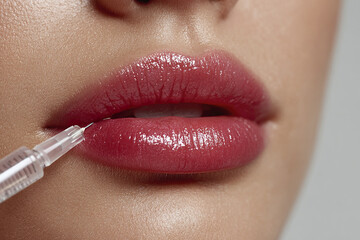 Naklejka premium Lip filler augmentation procedure close up of glossy red lips with syringe needle injecting for cosmetic enhancement and beauty treatment on smooth skin