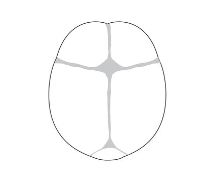 Infant skull anatomy diagram showing cranial sutures and fontanelle, top view