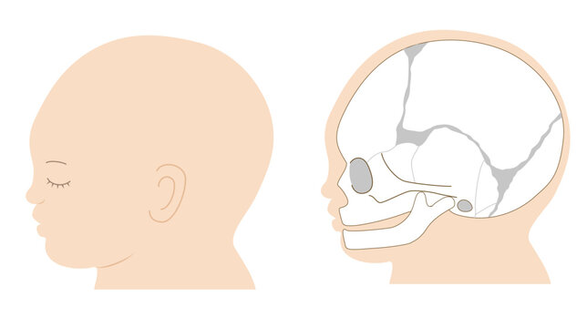 Infant skull anatomy diagram showing cranial sutures, side view