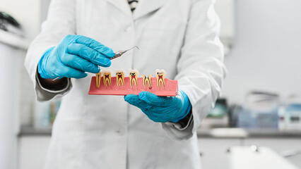 Stages of dental caries and pulpitis development on an anatomical model of a human tooth,...