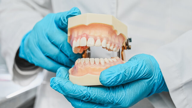 dentist wearing sterile gloves holds anatomical model of human jaw. close-up no face, making it unrecognizable. Gum inflammation, periodontal disease, stomatitis, gingivitis. 