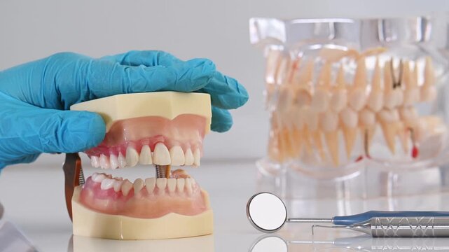 dentist wearing sterile gloves holds anatomical model of human jaw. close-up no face, making it unrecognizable. Gum inflammation, periodontal disease, stomatitis, gingivitis.
