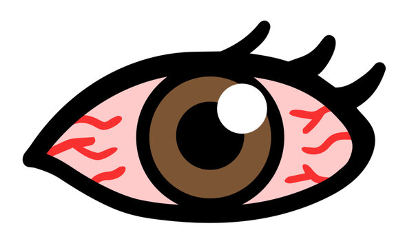 充血した目のイラストセット：眼精疲労・花粉症・目のトラブル