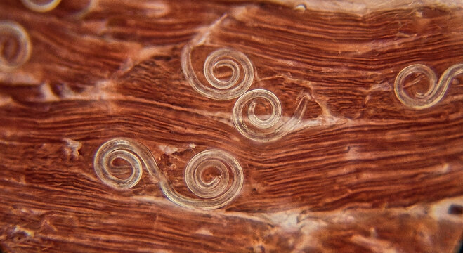 Trichinella spiralis larvae seen under a microscope. It is a parasitic nematode, enclosed in muscle tissue