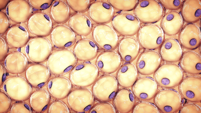 Adipocyte fat cells microscopic view. Obesity and weight loss pathology. Lipid accumulation and cellular hypertrophy, metabolic dysfunction and chronic inflammation.