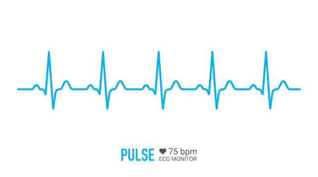 A medical ecg monitor displaying a normal pulse rate on a black background