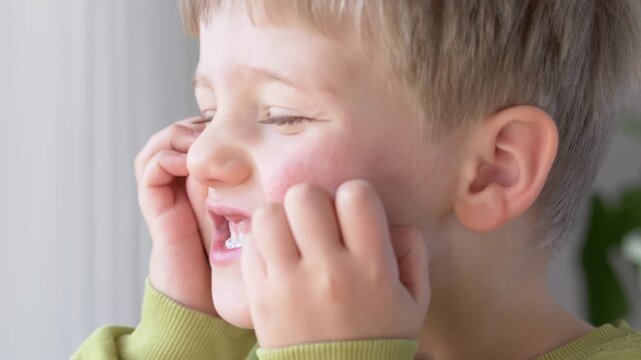Boy scratching red cheek, visible rash showing allergy, atopic dermatitis, parvovirus B19 or erythema infectiosum. Pediatric dermatology concept with treatment. Boy with irritated skin. 