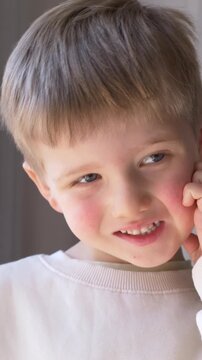 Boy scratching cheek shows skin rash and irritation clearly. Itch symptom reflects allergy reaction with discomfort, redness and inflamed sensitive child skin condition. Child touching face