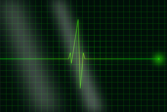 Abstract medical EKG heartbeat monitor animation
