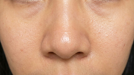 Fototapeta premium Oily facial skin texture and pores in macro closeup portrait