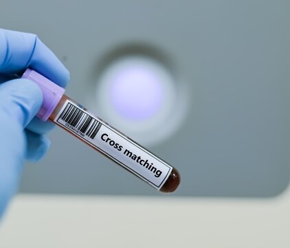 Blood sample tube for cross matching test analysis.