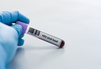 Fototapeta premium Blood sample tube for HIV viral load test analysis.