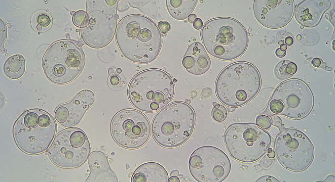 Detailed microscopic image of fungal yeast cells displaying active budding process, featuring circular spherical organisms with distinct biological cell walls and cytoplasmic structures.
