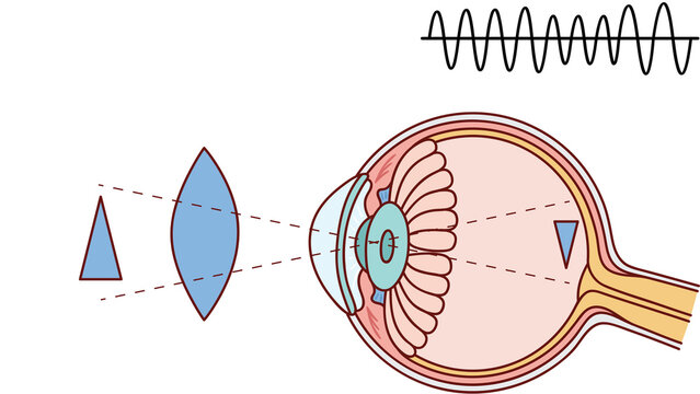 Human Eye Anatomy and Vision Correction Diagram with Convex Lens and Light Waves