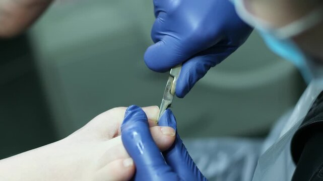 Man uses bronze nail clippers on little toe in low light with dark background. High quality 4k footage
