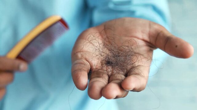 Man holding clump of fallen hair and comb with spoon, hair loss problem concept close up