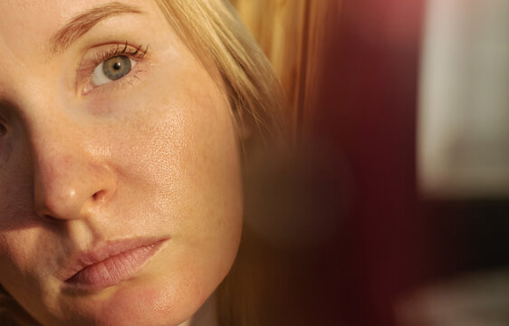 Close-up of female face with enlarged pores and oily skin, visible texture, redness on chin. Natural light beauty portrait, skincare concerns, dermatology concept.
