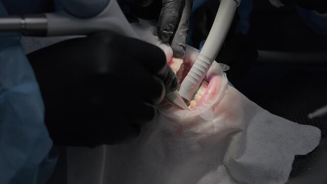 Professional dental hygienist performing a deep teeth cleaning and polishing procedure on a patient using an air polisher tool and saliva ejector to remove plaque and stains