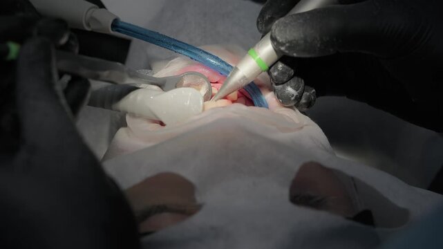 Dental hygienist performing a professional teeth cleaning procedure using an air polisher and a saliva ejector to remove plaque and stains from the patient's teeth in a modern clinic