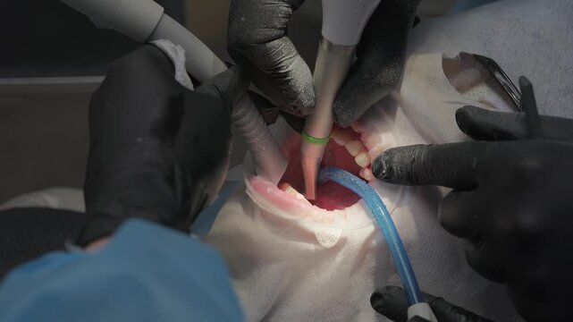 Professional hygienist performing a deep cleaning and plaque removal on a patient's teeth using an air polisher tool and a saliva ejector in a modern dental clinic during a regular check-up