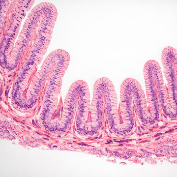 Small Intestine Villi Histology With Simple Columnar Epithelium