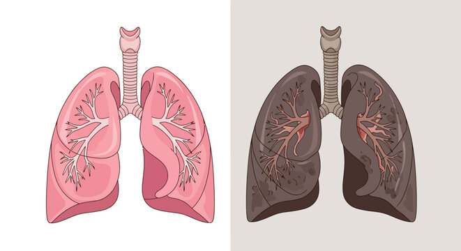 Healthy and smoker lungs comparison.