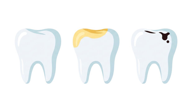 A vector graphic illustration of three teeth with different dental problems