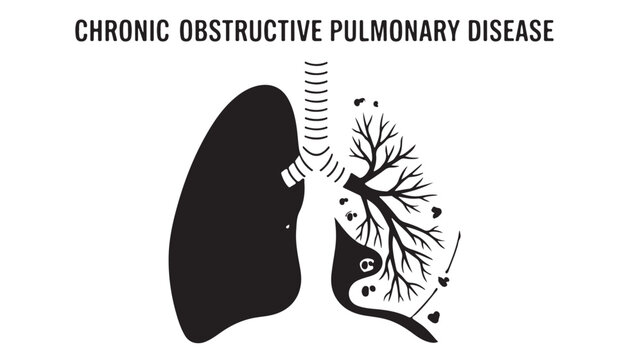 Chronic Obstructive Pulmonary Disease COPD lung vector illustration