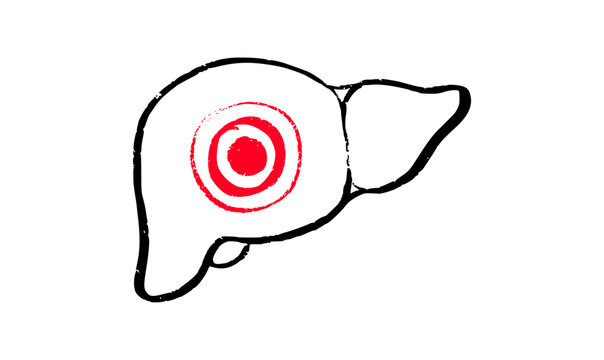 Liver disease concept