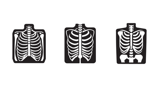 Human skeleton anatomy xray images in different views  medical illustrations of ribcage and spine