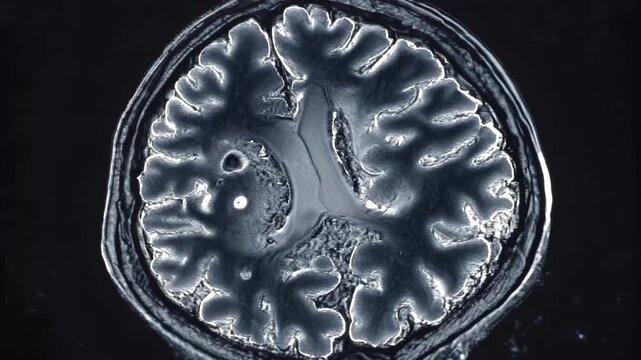 Brain scan shows detailed structure of human brain at a medical facility during imaging session in the afternoon