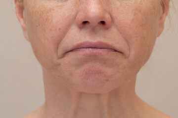 Naklejka premium Midface of woman with grim expression to show the reason of nasolabial folds
