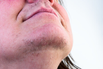 Fototapeta premium Woman's face with moustache and hairs on chin.