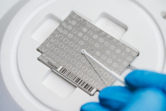 Glass Plate Labeled With Barcode For Tracking. Closeup Of Assay Plate With Barcode And Sample Handling