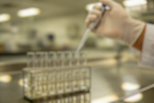 Scientist using a pipette in a modern laboratory with blurred background, highlighting precision, research, and innovation in science and healthcare.