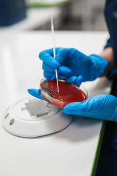 Sterile Lab Procedure. Closeup View Showcasing Careful Process Of Bacterial Sample Transfer On Petri Dish
