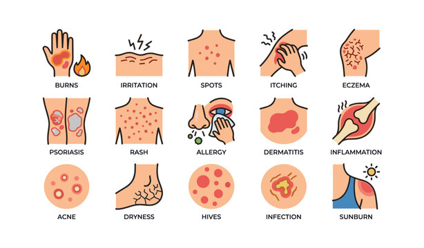 Skin conditions: visual guide to common symptoms and ailments