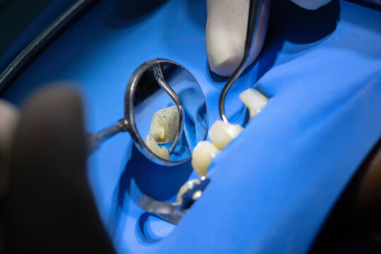 close-up of an endodontic root canal treatment process using a rotary file and dental dam. professional dentist performing endodontic therapy for tooth restoration in a clinic.