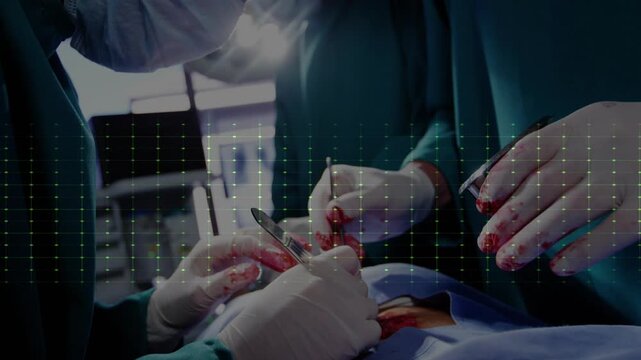 Cutting masked surgeon holding scalpel, forceps over draped torso in OR operating as ECG pulsing