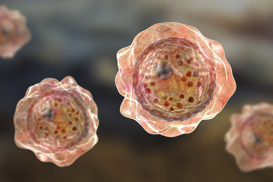 Balamuthia cysts, 3D illustration
