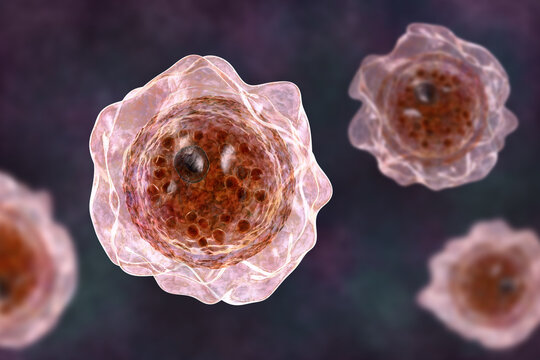 Balamuthia cysts, 3D illustration