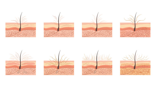Comparative medical diagrams showing different stages of human hair follicle growth and various skin health conditions.